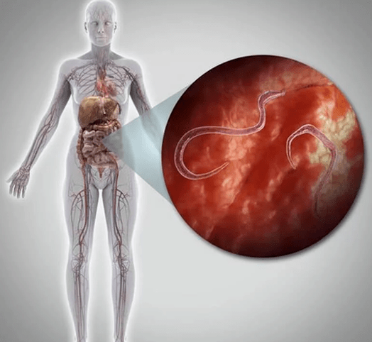 Parasitas no corpo humano